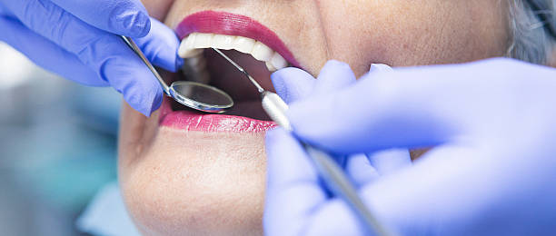 Best Knocked-Out Tooth (Avulsed Tooth) Treatment in Carlin, NV